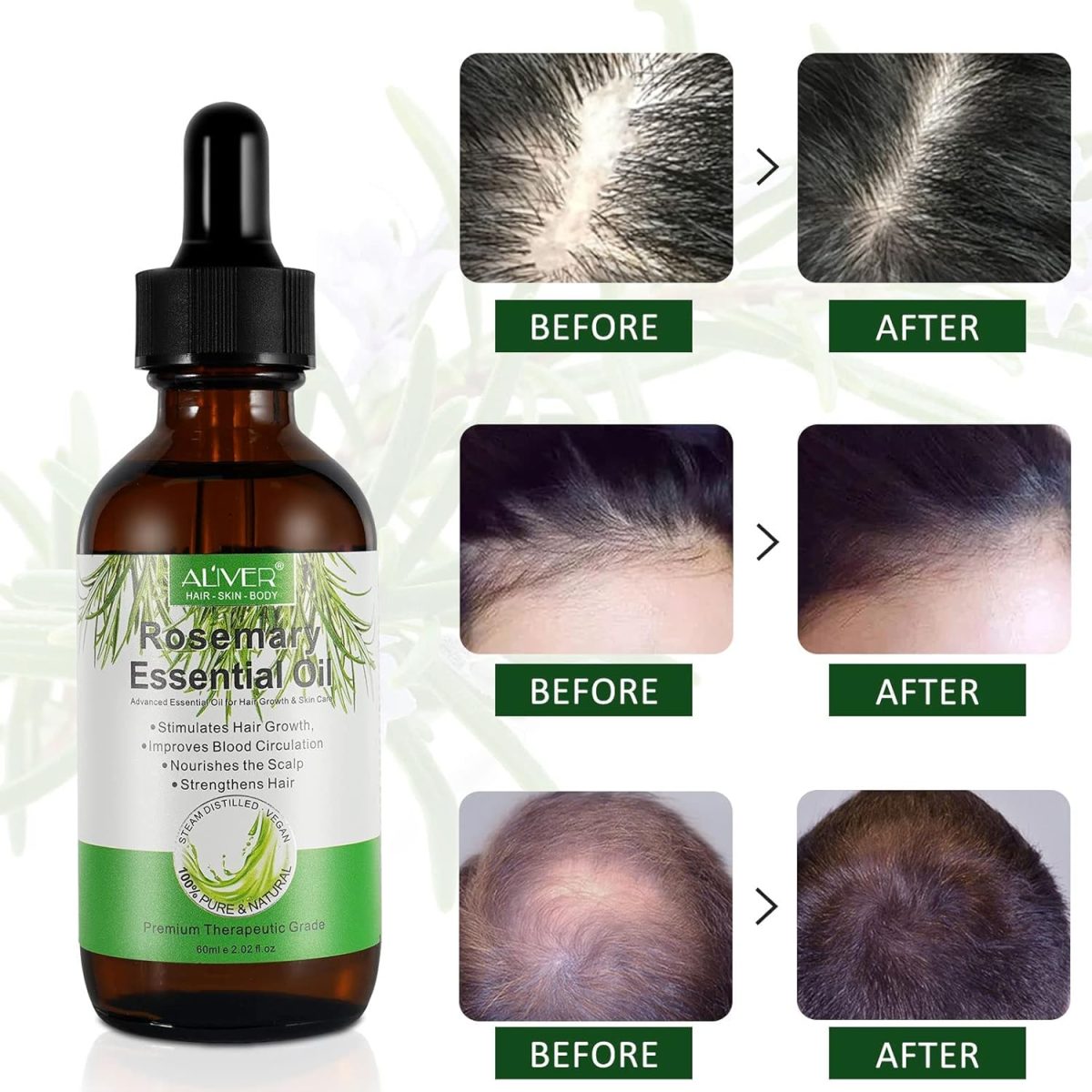 1732707721 ALIVER UEPETU Rosemary Oil for Hair Growth 2 Fl Oz Pure Organic Rosemary Essential Oils Serum for Dry Damaged Hair and Growth Hair Loss Scalp Treatment