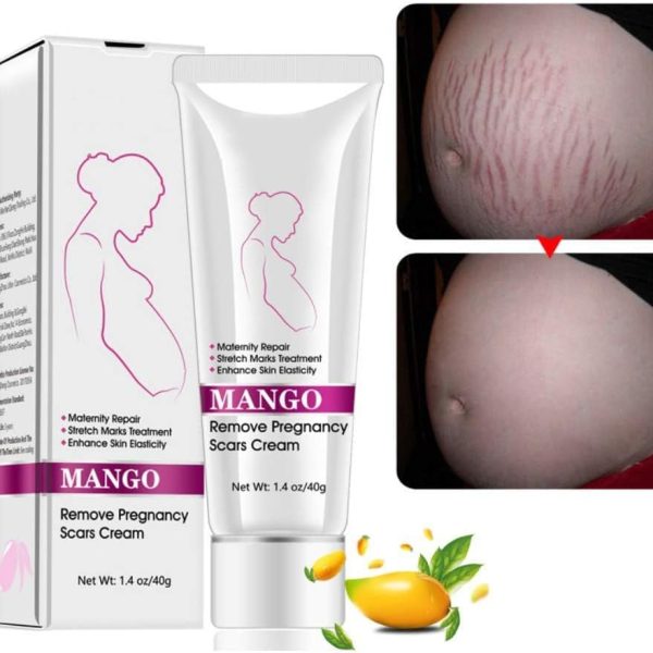 NALACAL Mango Stretch Marks and Scar Cream Stretch Marks Scar