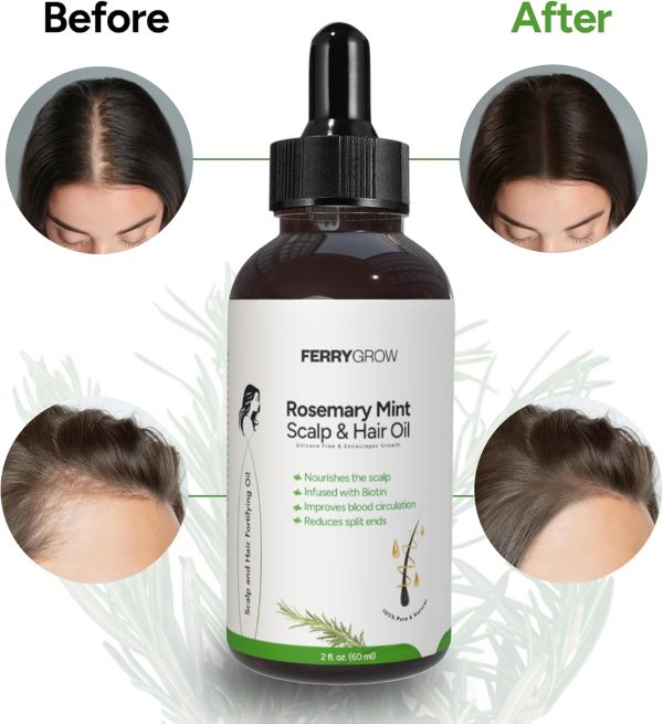 1733990196 FerryGrow Rosemary Mint Scalp Hair Oil 60 ml Hair Growth Oil with Biotin for Thicker Stronger Hair Scalp Treatment Nourishing Oil for Damaged Hair Healthy Shine