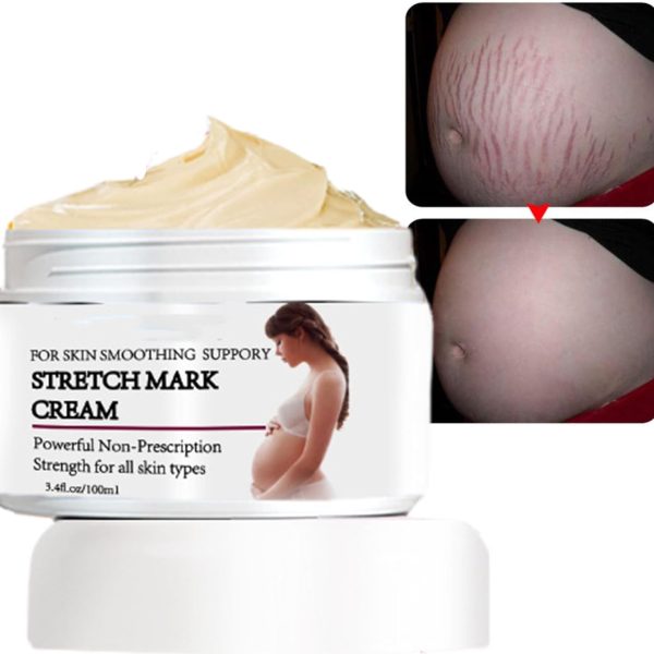 KASTWAVE Stretch Marks and Scar Cream, Stretch Marks and Scar Removal Cream for Pregnancy, Stretch Marks Scar Belly Creams for Wrinkles, Obesity Fat Stretch Mark Moisturizing, Remove Marks (100ml)