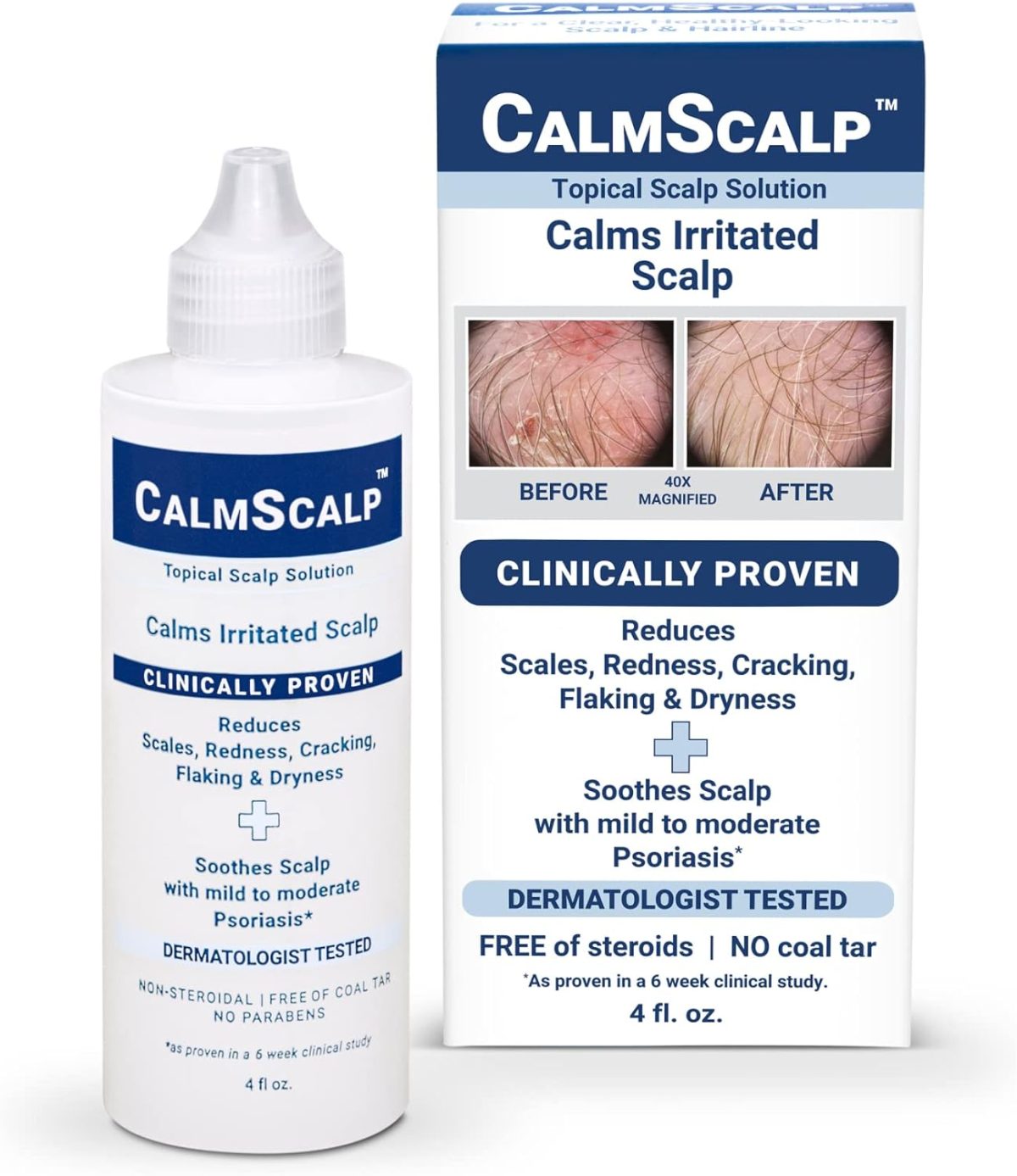 CalmScalp Topical Solution for Symptoms of Mild to Moderate Psoriasis | Irritated Scalp | Hairline Scales | Redness | Dry Scalp | Made in The USA | 4 oz.